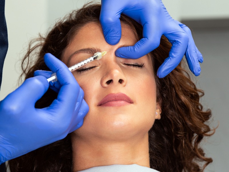 تزریق بوتاکس ابرو برای خط اخم