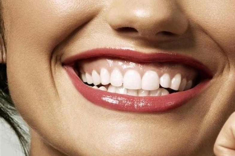 بوتاکس لبخند لثه ای
