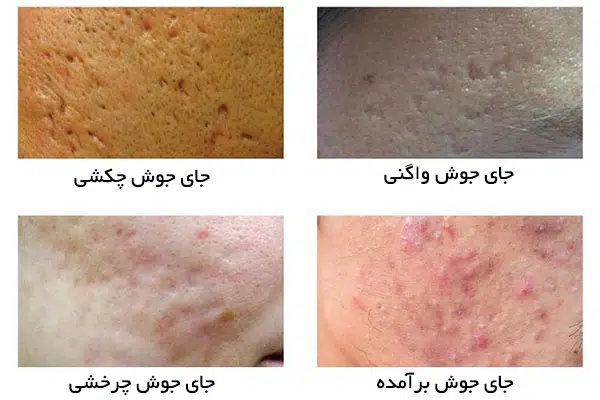 اسکار جوش