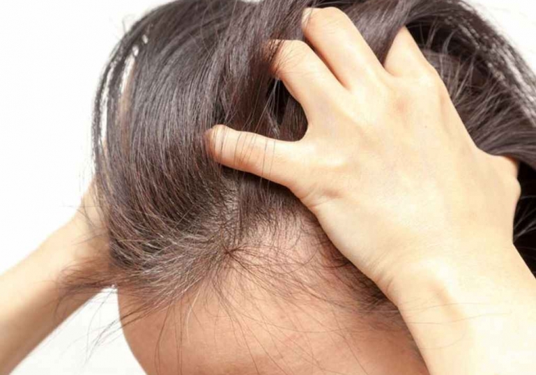 بیماری های پوست سر