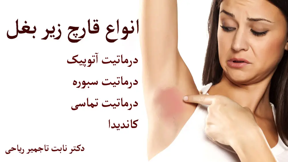 کیست زیر بغل چه علائمی دارد؟