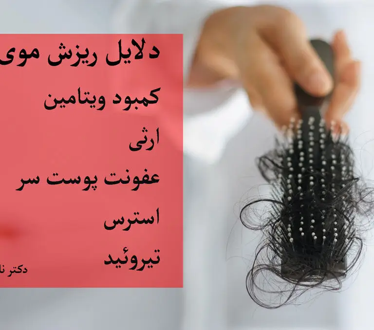 دلایل ریزش مو