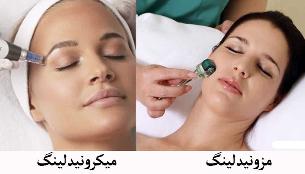میکرونیدلینگ