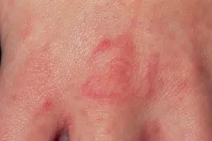 عکس گال