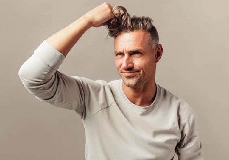 ماینوکسیدیل ۱۰ درصد برای ریزش مو