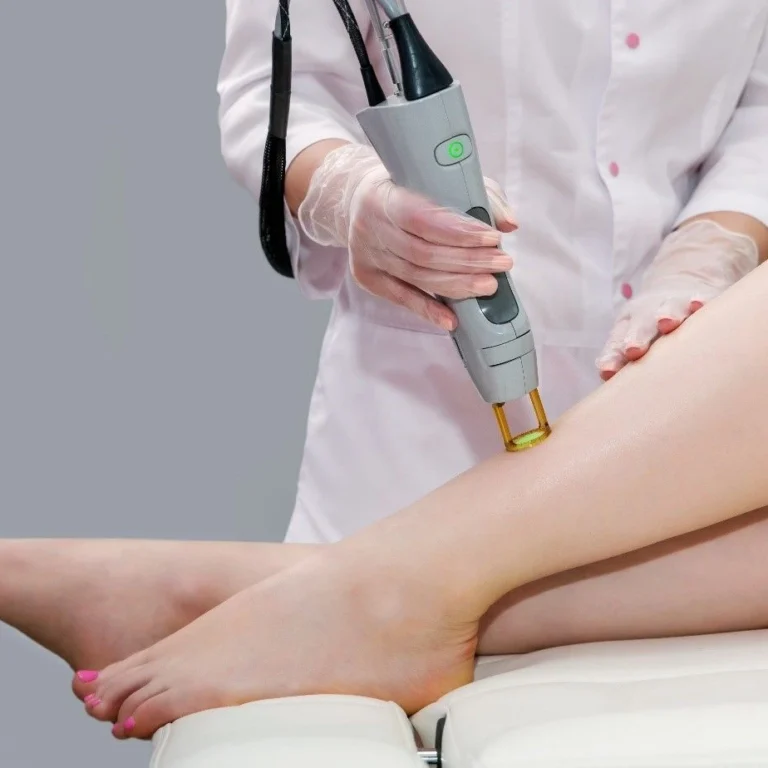 تاثیر نوع دستگاه لیزر در برگشت مو