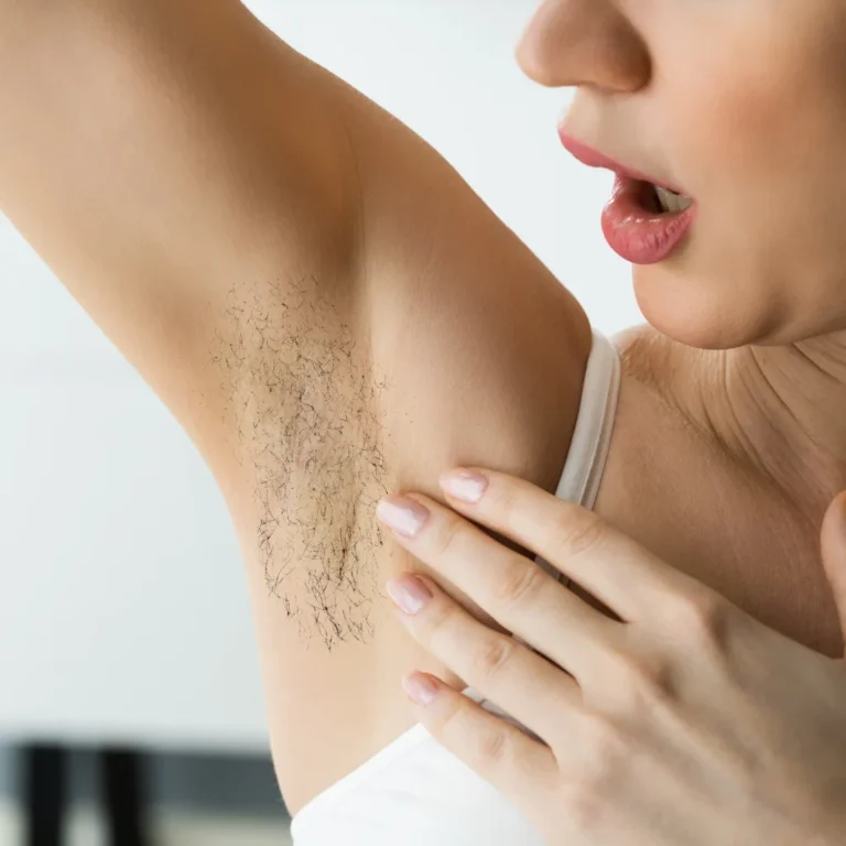 برگشت مو در خانم‌ها