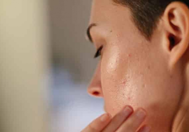 سابسیژن برای جای جوش عمیق