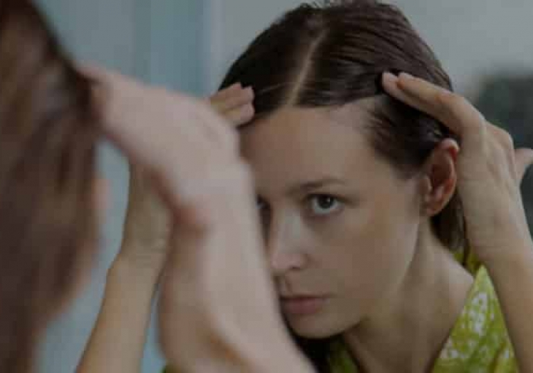 راه های جلوگیری از ریزش مو در نوجوانان