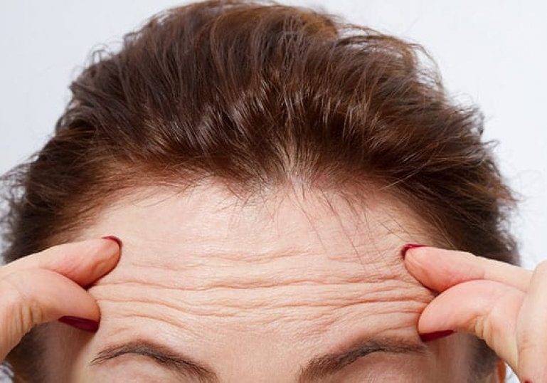 آیا بوتاکس باعث افتادگی پوست میشود