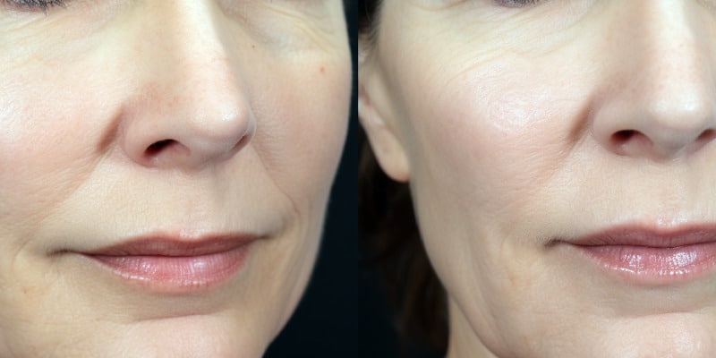 اهمیت کلاژن و الاستین پوست​